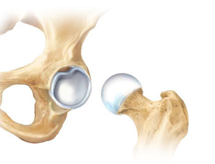 Hip joint